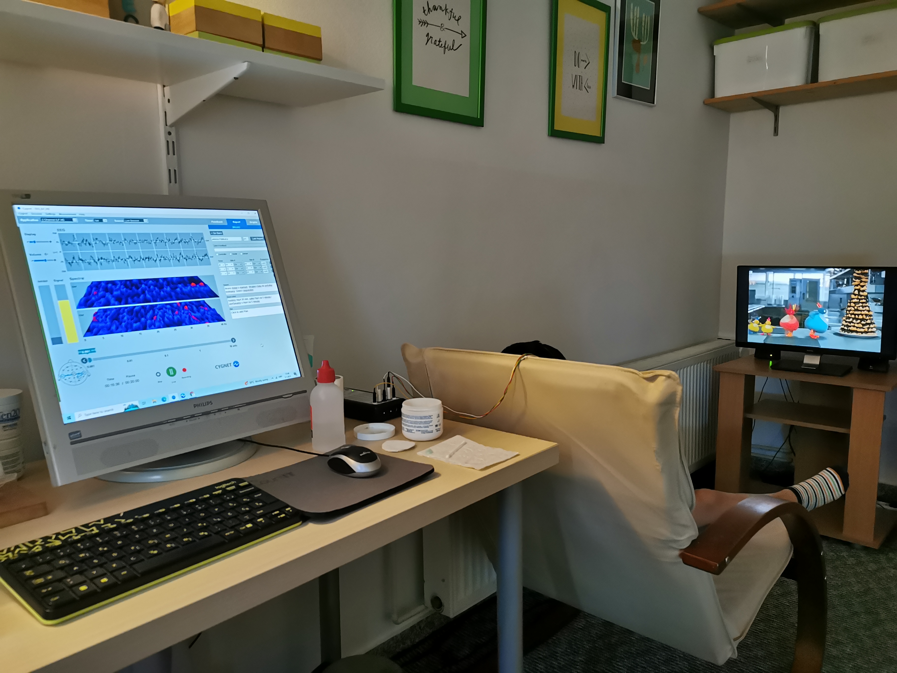 Neurofeedback